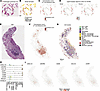 Identification and characterization of tertiary lymphoid structures (TLS) u