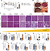 Hepatic and renal characteristics of Hnf1a+/Δe4-10 mice.