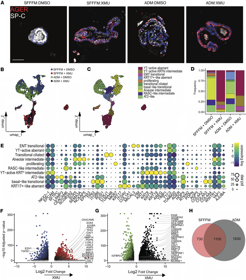 YAP/TAZ activation leads to aberrant epithelial cell populations in huma...