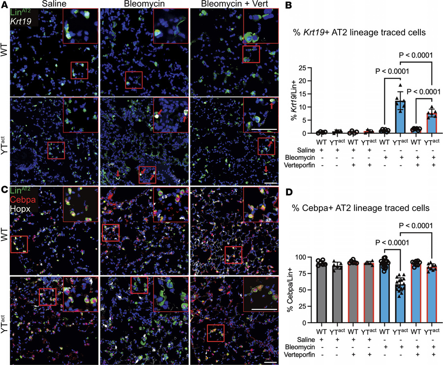 Sustained YAP/TAZ activation leads to aberrant alveolar epithelial cell ...