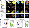 YAP/TAZ activation alters cell morphology in human organoids.