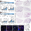 YTactive mice show increased and sustained fibrotic remodeling.