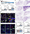 The YAP/TAZ inhibitor verteporfin partially rescues fibrotic phenotype in Y