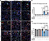 Sustained YAP/TAZ activation leads to aberrant alveolar epithelial cell dif