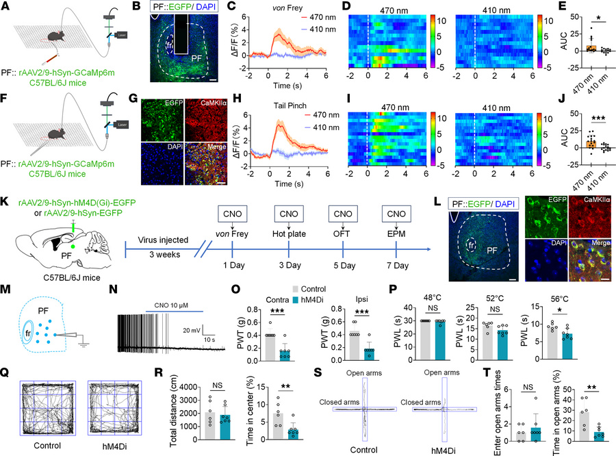 Nociceptive stimuli activate PFCaMKIIα neurons in mice.
(A and F) Schema...