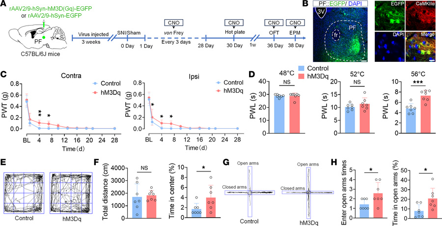 Activation of PFCaMKIIα neurons alleviates pain and anxiety-like behavio...