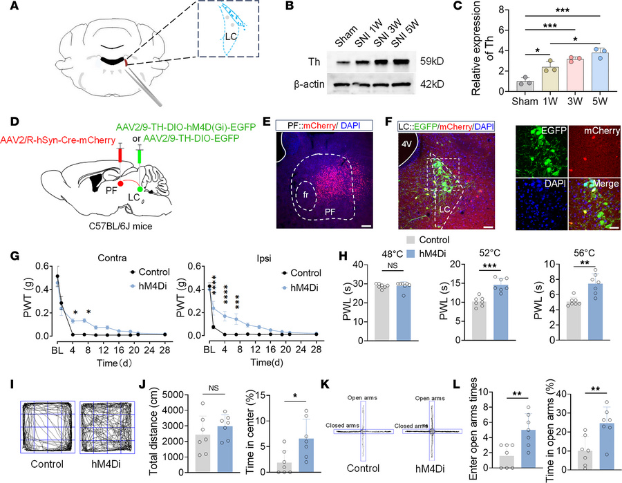 Inhibition of the LCNE-PFCaMKIIα neural pathway alleviates pain and anxi...
