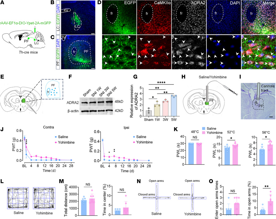 ADRA2 in the PF mediates chronic pain and anxiety.
(A) Schematic of ante...