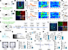 Nociceptive stimuli activate PFCaMKIIα neurons in mice.