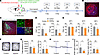 Activation of the LCNE-PFCaMKIIα neural pathway promotes nociceptive hypers