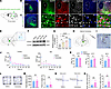 ADRA2 in the PF mediates chronic pain and anxiety.