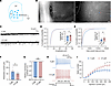 Yohimbine increases the intrinsic excitability of PF neurons.