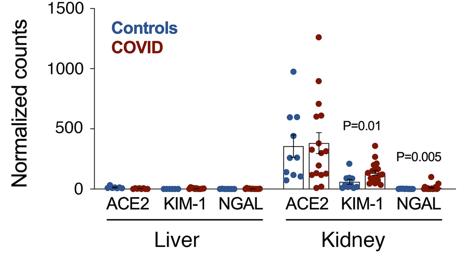 Comparison of KIM-1, LCN2/NGAL, and ACE2 mRNA abundance in autopsy kidne...