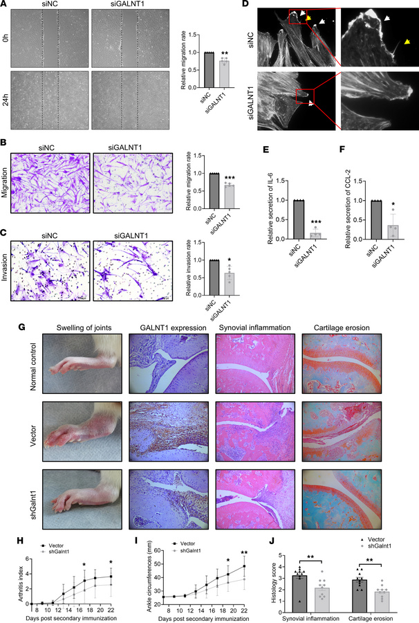 GALNT1 promotes aggressiveness of RA FLSs and severity of CIA in rats.
(...