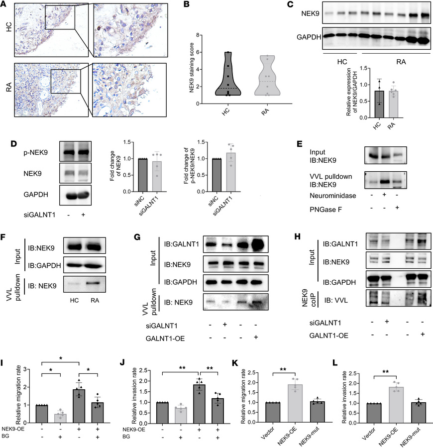 GALNT1-mediated O-glycosylation of NEK9 in RA FLSs promotes migration an...