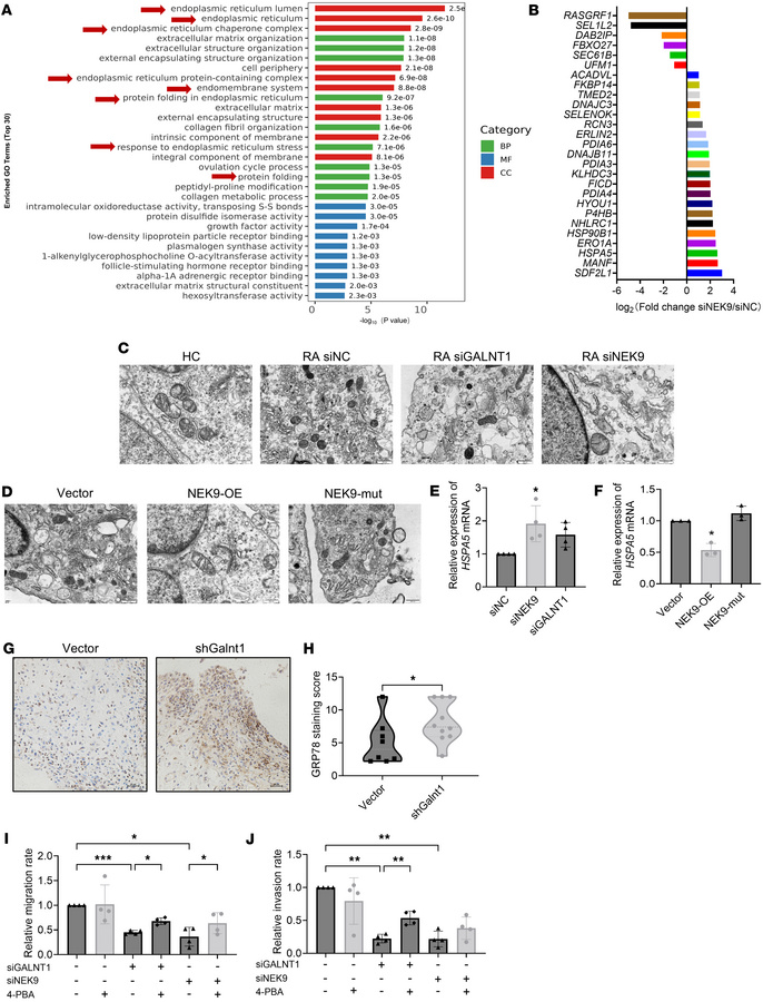 NEK9 regulates the migration and invasion of RA FLSs through the regulat...