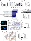Enhanced O-glycosylation and GALNT1 expression in RA FLSs and synovial tiss