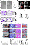 GALNT1 promotes aggressiveness of RA FLSs and severity of CIA in rats.