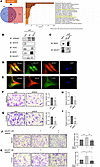 GALNT1 functions by interacting with NEK9.