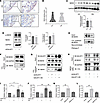 GALNT1-mediated O-glycosylation of NEK9 in RA FLSs promotes migration and i