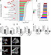 NEK9 regulates cytoskeleton organization in RA FLS.