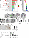 NEK9 regulates the migration and invasion of RA FLSs through the regulation