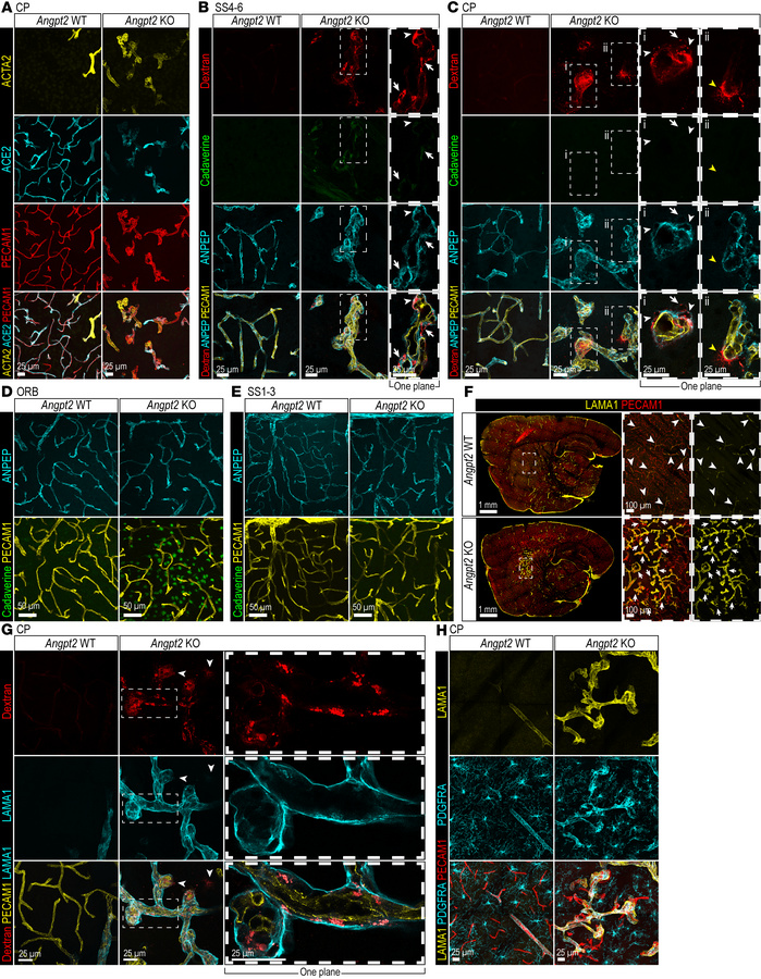 Phenotypes of brain perivascular cells in Angpt2-KO brains.
(A) Represen...