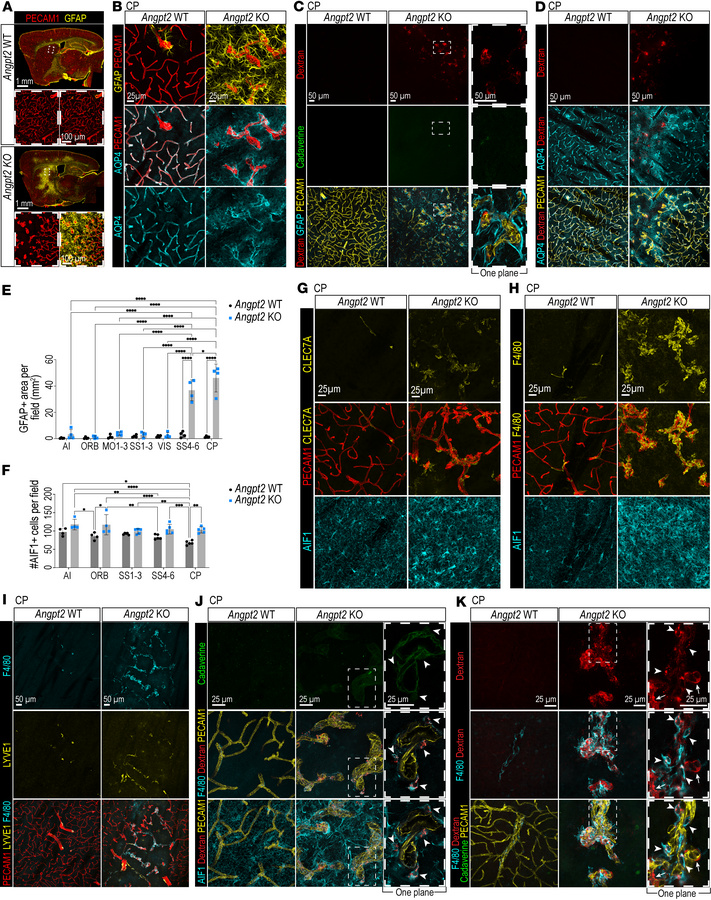 Glial phenotypes in Angpt2-KO brains.
(A) GFAP (yellow) and PECAM1 (red)...