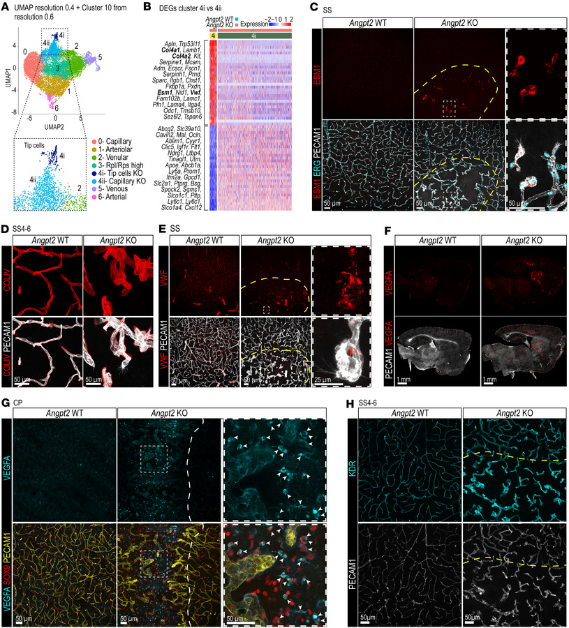 Characterization of angiogenic transcriptional changes in Angpt2-WT and ...