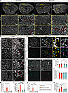 Vascular malformations and vascular sprouting in adult Angpt2-KO brains.
