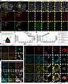 BBB permeability and endothelial junctions in Angpt2-KO brains.