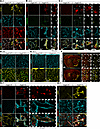 Phenotypes of brain perivascular cells in Angpt2-KO brains.