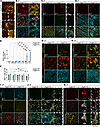 Glial phenotypes in Angpt2-KO brains.