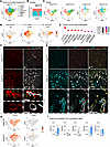 ScRNA-seq analysis in Angpt2-WT and -KO mice.
