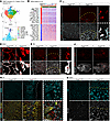 Characterization of angiogenic transcriptional changes in Angpt2-WT and -KO