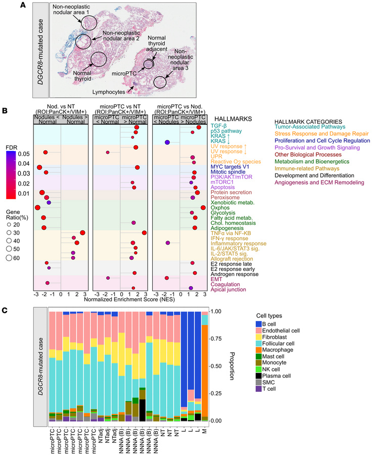 Transcriptomic profiles of DGCR8-mutated thyroid lesions.
(A) H&amp;E st...