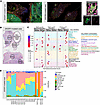 Transcriptomic profiles of a DICER1 thyroid lesion.