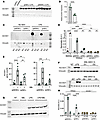 Human macrophages are feeble producers of itaconate with Mtb infection.