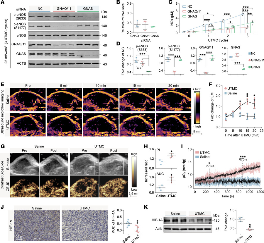 Effects of G protein knockdown on eNOS activation and tumor perfusion im...