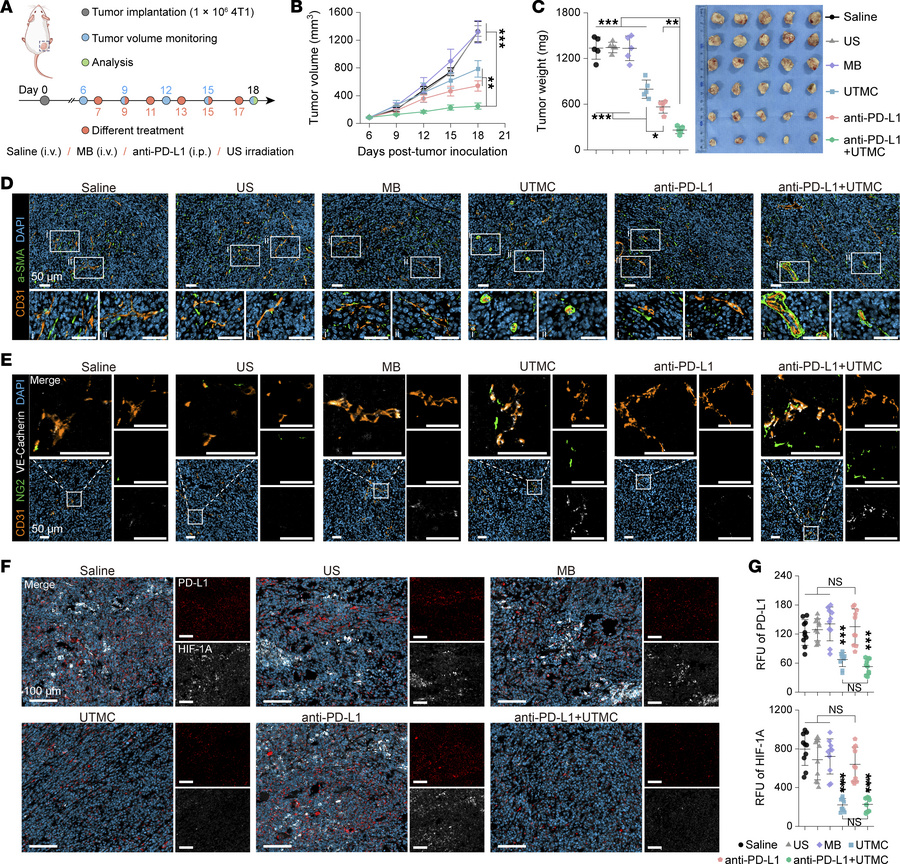 Evaluation of antitumor effects of UTMC combined with immune checkpoint ...