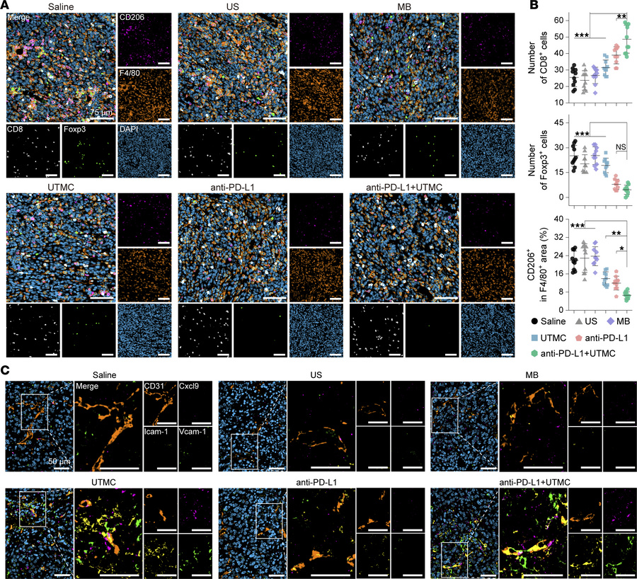 Multiplex immunofluorescence analysis of tumor tissues following UTMC co...