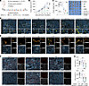 Evaluation of antitumor effects of UTMC combined with immune checkpoint blo