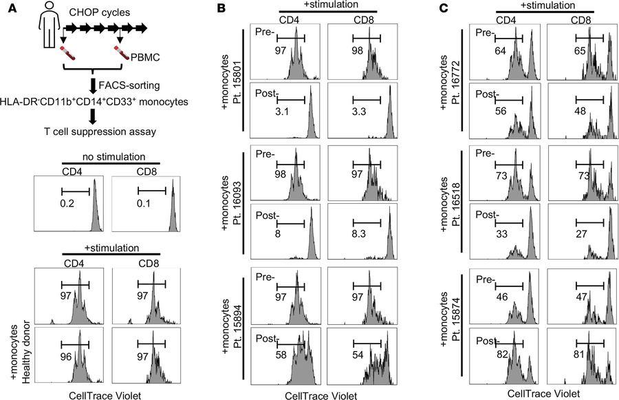 Emergence of immunosuppressive monocytes in the PBMCs of lymphoma patien...