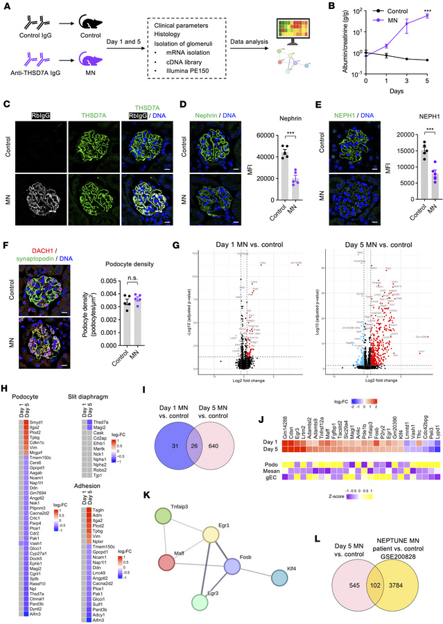 Temporal transcriptomic changes in experimental THSD7A-associated MN.
(A...