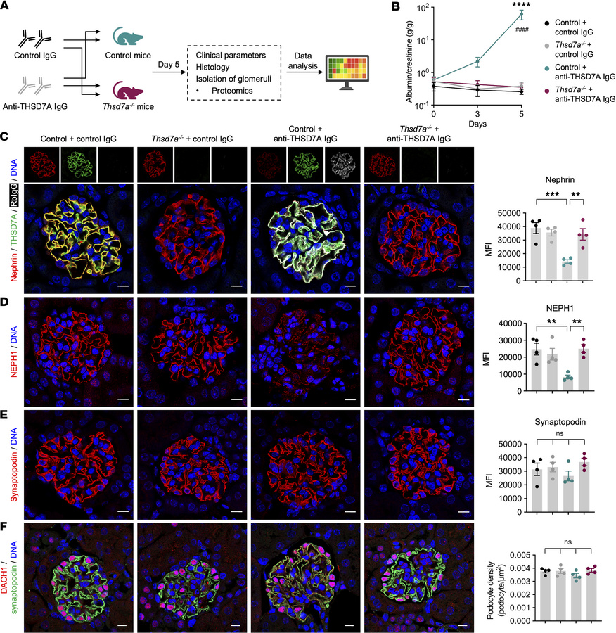 Podocyte-specific Thsd7a–/– mice are protected from antibody-induced pod...