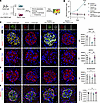 Podocyte-specific Thsd7a–/– mice are protected from antibody-induced podocy