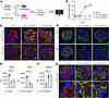 Complement C3 deficiency attenuates proteinuria but not slit diaphragm prot