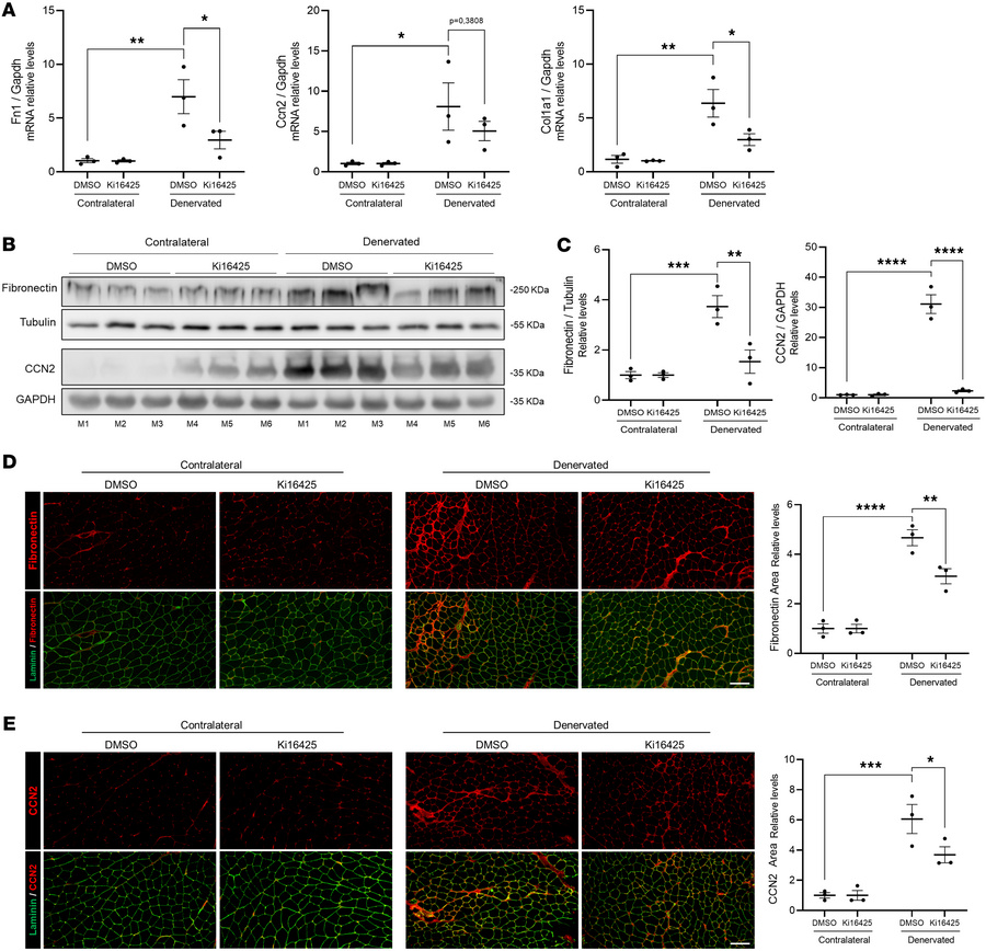 Pharmacological inhibition of LPA1 and LPA3 reduces the fibrotic respons...