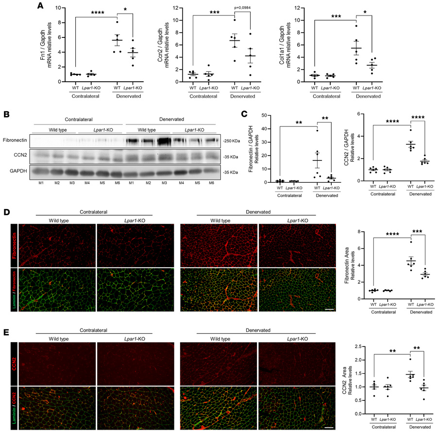 
Lpar1 ablation prevents the skeletal muscle fibrotic response to denerv...