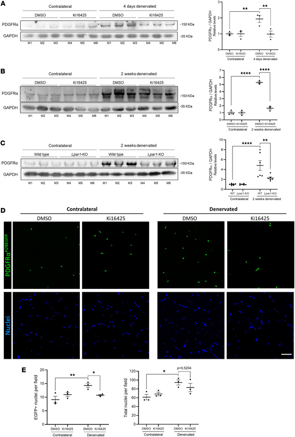 LPA1 is required for FAP increase after denervation.
(A) Immunoblot and ...